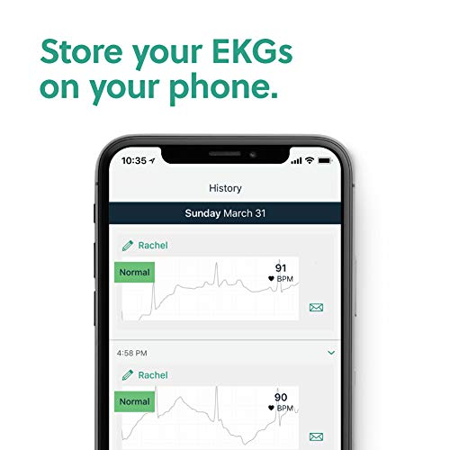 AliveCor, Kardia Mobile