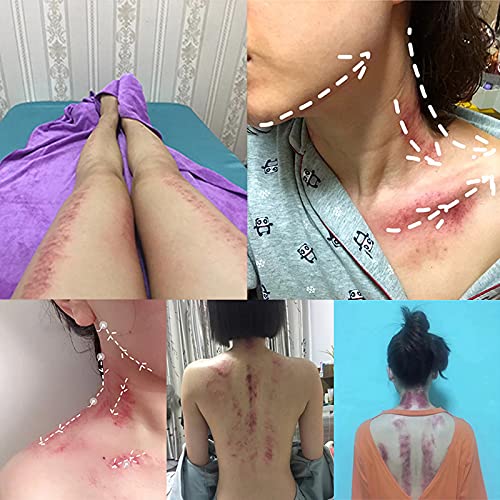 BAQI 1 herramienta de drenaje linfático de madera, herramientas de masaje de terapia de raspado de gua sha de madera, herramienta de esculpir el cuerpo para piernas traseras brazos