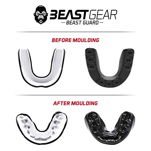 ﻿﻿Beast Gear Protector Bucal Boxeo, Rugby, Futbol Americano, Hockey, MMA y Karate - Accesorios Profesionales para Protección de la Boca y los Dientes