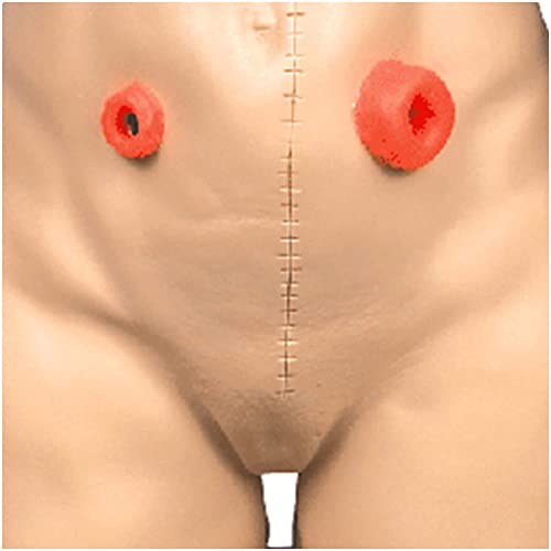 BJH Modelo de ileostomía de colostomía - Modelo de enfermería de ostomía de fístula Avanzada - para Suministros de enseñanza de capacitación y educación de enfermería, tamaño Real (Car