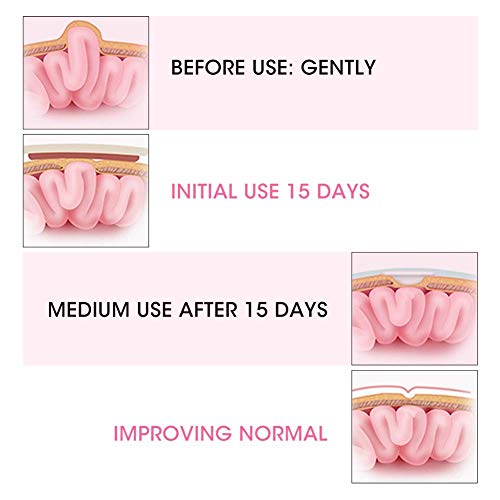 Cinturón De Hernia Para Bebés, Banda Para El Ombligo Del Bebé, Tratamiento De Cinturón De Hernia De 2 Piezas Para , De Hernia Umbilical Para Recién Nacidos Cinturón (Rosado)