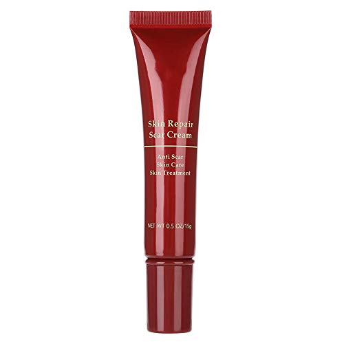 Crema para eliminar cicatrices del acné, reparación de la piel, para la cara, manchas para el acné, crema para blanquear puntos negros, crema antiestrías