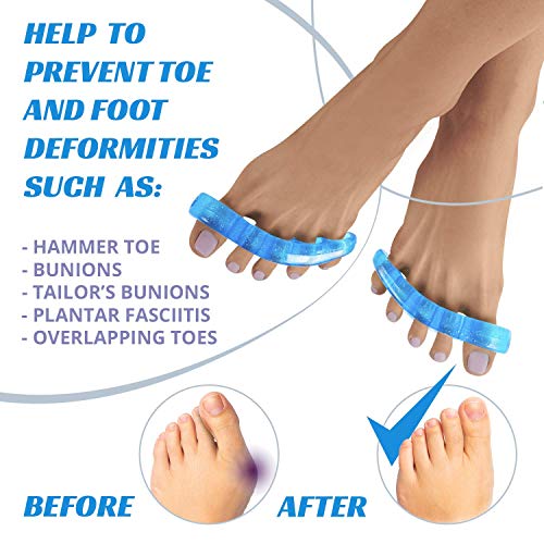 DOACT Juanete Corrector Protector con Gel Almohadilla, Funda de Férula de Silicona Calcetín Juanete Calcetines para Pulgar Dedo del Pie, Aliviar el Dolor Hallux Valgus, Hombres y Mujeres