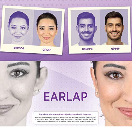 EARLAP Cosmetic Ear Corrector - Resuelve el problema de las orejas grandes - Correctores estéticos para orejas prominentes - Correctores de orejas sobresalientes, sin cirugía Contiene 20 correctores