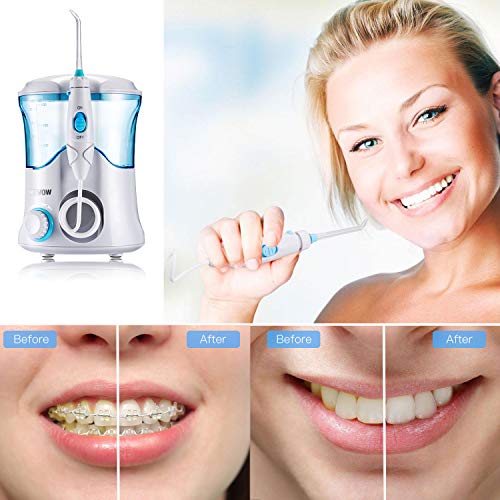 Irrigador Dental Professionale con 8 Boquillas Multifuncionales, Jkevow Irrigador Bucal Limpieza Dientes con Capacidad de 600ml, 10 Ajustes de Presión del agua (Blanco)