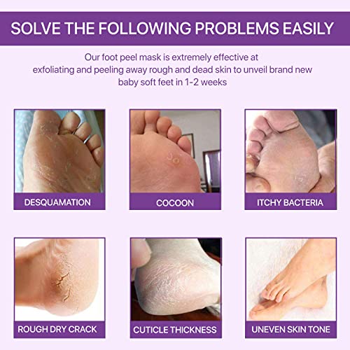Paquete de 3 mascarillas exfoliantes para los pies, calcetines exfoliantes para los pies, callosidades, removedor de piel muerta, mascarilla exfoliante para los pies con aloe para pieles secas