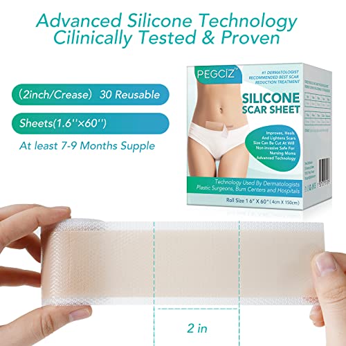 Parches para Cicatrices 1.6 "X 60" Reducción de Cicatrices Hojas de Cicatriz de Silicona Eliminación de Cicatrices Rápida y Eficaz para Cesáreas, Queloides