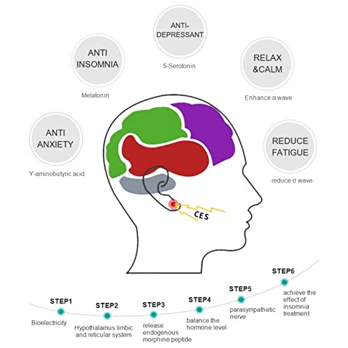 SSSW El Instrumento de sueño Mejora el sueño, Nuevo Ces La electroterapia intracraneal estimula el Equipo Anti-insomnio, Alivia la ansiedad y Mejora la Calidad del sueño