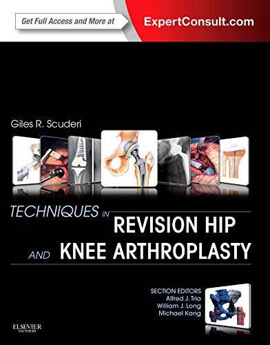 Techniques in Revision Hip and Knee Arthroplasty, 1e