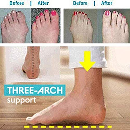 TOT Las Mujeres del juanete del pie Corrector Sandalias Dedo Gordo Hueso ortopédico Zapatillas con Ayuda de Arco para síntomas de Alivio del Dolor del juanete Hallux valgus Zapatos Abiertos,Negro,39