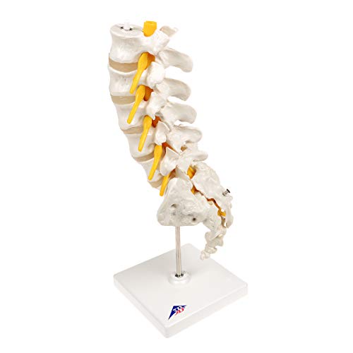 3B Scientific A76/5 Modelo de anatomía humana Columna Vertebral Lumbar Con Hernia Discal Dorso lateral + software de anatomía gratuito - 3B Smart Anatomy