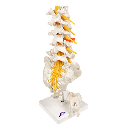 3B Scientific A76/5 Modelo de anatomía humana Columna Vertebral Lumbar Con Hernia Discal Dorso lateral + software de anatomía gratuito - 3B Smart Anatomy