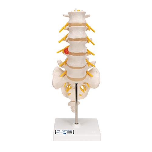 3B Scientific A76/5 Modelo de anatomía humana Columna Vertebral Lumbar Con Hernia Discal Dorso lateral + software de anatomía gratuito - 3B Smart Anatomy