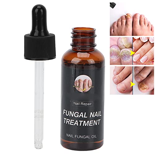 Aceite para el Cuidado de las Uñas, Tratamiento de Reparación de Uñas Suave 50 Ml para el Hogar para el Engrosamiento de las Uñas