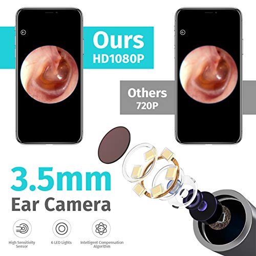 BEBIRD C3 Otoscopio Limpiador de oídos herramienta de eliminación de cera para endoscopio con cámara 1080P HD para teléfonos inteligentes iPhone, iPad y Android （Blanco）
