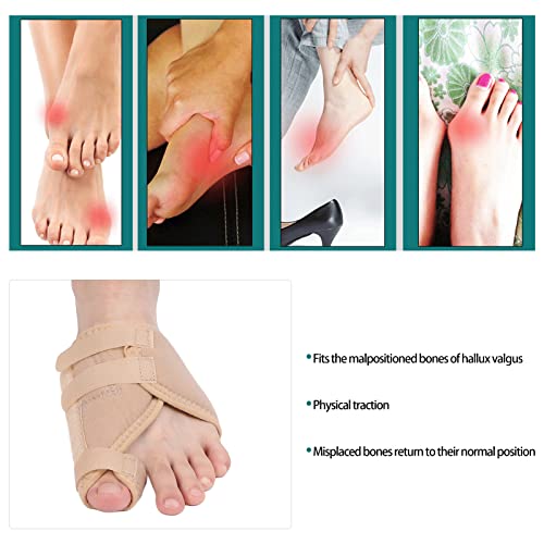 Corrector de Hallux Valgus, Férula de Juanete Lavable para Hombres Y Mujeres para Clínica Casera para el Cuidado de los Pies(Pie izquierdo)