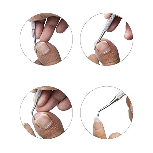 Cortaúñas para dedos de los pies con lima para uñas encarnadas o gruesas, recortador de uñas de los pies y pinza de uñas de podólogo profesional para personas mayores