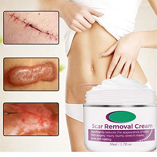 Crema para Revitalizar La Piel Sin Cicatrices, Crema para Eliminar Cicatrices, Crema para Cicatrices QuirúRgicas, Crema para EstríAs Para El Embarazo, Crema para Quemar Cicatrices (1 pieza)