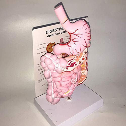 DIELUNY Paradigma pedagógico Intestino Grueso Úlcera de estómago Cúbito Patología patológica Modelo anatómico - Modelo de órgano Modelo del Sistema digestivo Humano PVC Humano