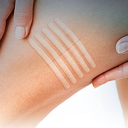 Eurosuture (mm 6 x mm 75) Tiras Estériles Para Sutura Cutánea, Adhesivo Hipoalergénico, Efecto Descolorado para un Mejor Resultado Cosmético. Paquete de 6 Unidades
