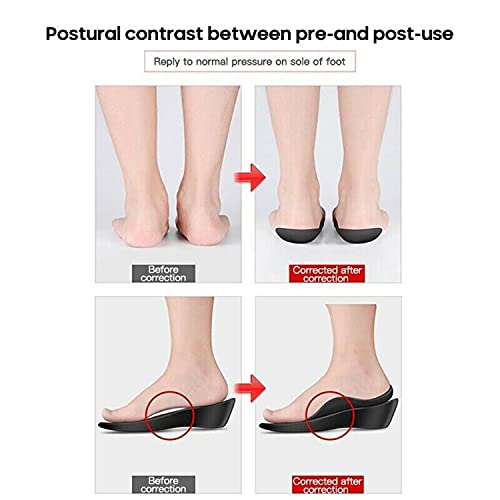 Flat Foot Orthopedic Insoles, Flatfoot O-Type Leg Foot Valgus Correction Shoe Insert,Arch Supports Relieve Plantar Fasciitis,for Fallen Arches Flat Feet Plantar Fasciitis (White, M（35~39）)
