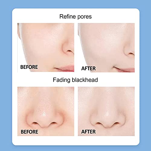iksvmsis Hidrógeno Y Oxígeno Máquina De Belleza, Máquina Facial De Hidrógeno Y Oxígeno, 6 En 1 Agua Hidrógeno Oxígeno Belleza Máquina para El Cuidado De La Piel Profunda Limpieza Exfoliante