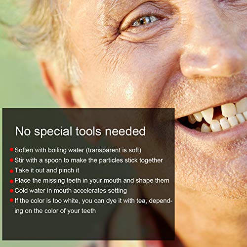 Kit de reparación de dientes, Kit de reparación de dientes temporal, Perlas de reparación de dientes temporales para dientes rotos faltantes Material de relleno de dientes dentales(20g)