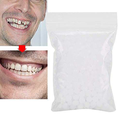Kit de reparación de dientes, Kit de reparación de dientes temporal, Perlas de reparación de dientes temporales para dientes rotos faltantes Material de relleno de dientes dentales(20g)
