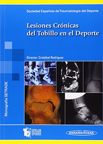 Lesiones cronicas del tobillo en el deporte