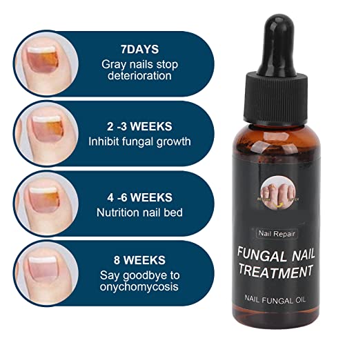 Líquido de Reparación de Uñas, Seguro, Profesional, Suave, Conveniente, Aceite para el Cuidado de las Uñas, 50 Ml, Protección de Uñas para el Hogar, para el Engrosamiento de las Uñas