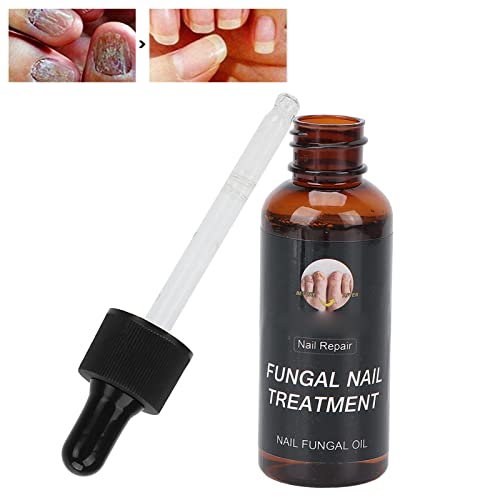 Líquido de Reparación de Uñas, Seguro, Profesional, Suave, Conveniente, Aceite para el Cuidado de las Uñas, 50 Ml, Protección de Uñas para el Hogar, para el Engrosamiento de las Uñas