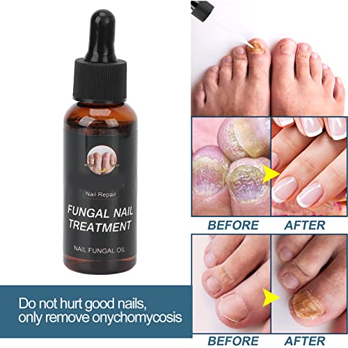 Líquido de Reparación de Uñas, Seguro, Profesional, Suave, Conveniente, Aceite para el Cuidado de las Uñas, 50 Ml, Protección de Uñas para el Hogar, para el Engrosamiento de las Uñas