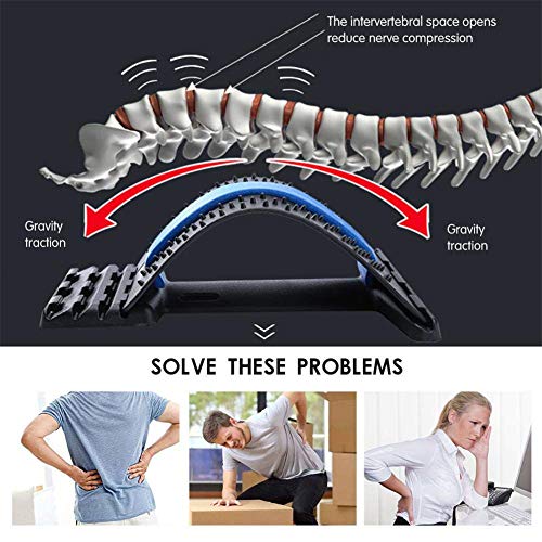 Magic Back Support Plus Stretch Mate Adjustable Back Right Lumbar Stretcher for Posture Correction and Pain Relief (Green)