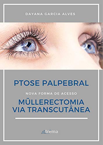 Müllerectomia via Transcutânea: Ptose Palpebral (1) (Portuguese Edition)