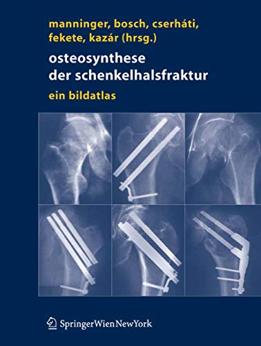 Osteosynthese der Schenkelhalsfraktur: Ein Bildatlas (German Edition)