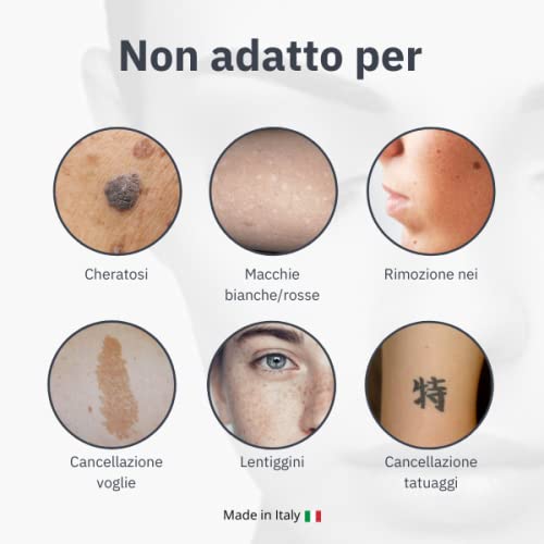 Q-WHITE crema gel aclarante para blanquear las manchas de la piel de varia origen (hipercromia, hiperpigmentaciòn, melasma, mancha solar, seniles, hormonales debidos a la inflamación postoperatoria.)