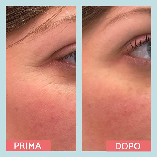 Remescar - Corrector de arrugas al instante - Probado clínicamente - Reducción de las arrugas y de los signos relacionados con la edad - Crema antiarrugas para hombre y mujer - Resultados inmediatos