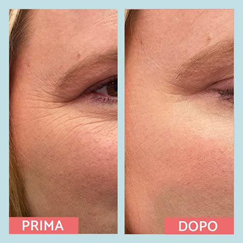 Remescar - Corrector de arrugas al instante - Probado clínicamente - Reducción de las arrugas y de los signos relacionados con la edad - Crema antiarrugas para hombre y mujer - Resultados inmediatos