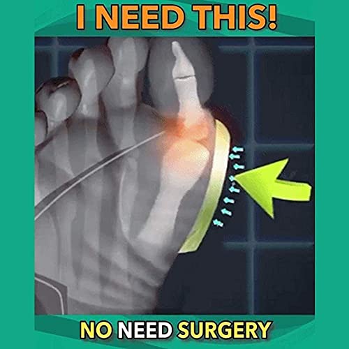 Sandalias de corrección ósea con dedo gordo para mujer, zapatos ortopédicos de piel de vaca con punta abierta, zapatillas correctoras de juanetes Hallux Valgus con soporte de arco para niñas, madre,
