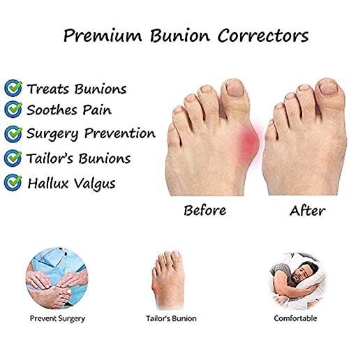 Sandalias de corrección ósea con dedo gordo para mujer, zapatos ortopédicos de piel de vaca con punta abierta, zapatillas correctoras de juanetes Hallux Valgus con soporte de arco para niñas, madre,