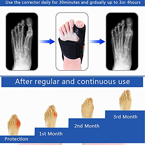Separadores de Dedos de los Pies para Aliviar el Dolor de Juanetes, Corrector de Férula de Juanetes Ajustable, Enderezadora del Dedo Gordo con Envoltura Suave para Doblar el Dedo del Pie(negro)