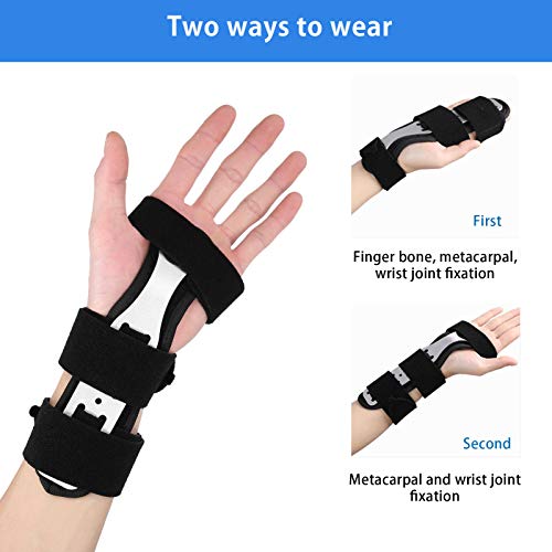 Soporte para Dedos de Mano, ANGGREK, Férula Transpirable para Dedos de Mano, Esguince, Recuperación de Fracturas, Soporte para Dedos, Inmovilizador, Soporte para Muñeca, Estabilizador para Dedos Rotos