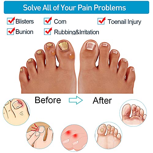 Sumiwish Protectores para dedos de los pies, 16 unidades de tapones de gel para los dedos, protectores de silicona para evitar ampollas, callos y maíz, alivia el dolor de uñas encarnadas