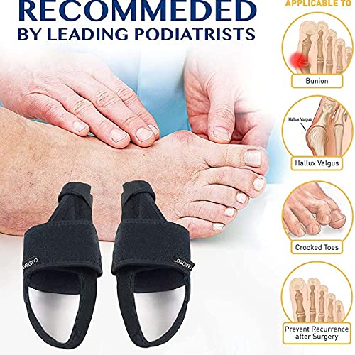 Tatoonly Corrector de dedo gordo Valgus ajustable pulgar separar la férula del juanete del hueso del dedo del pie restaurar la alineación natural