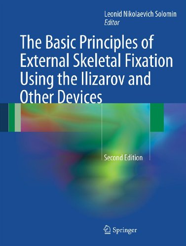 The Basic Principles of External Skeletal Fixation Using the Ilizarov and Other Devices (English Edition)