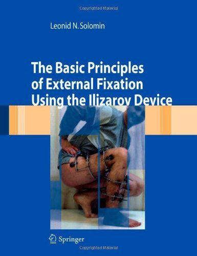 The Basic Principles of External Skeletal Fixation Using the Ilizarov Device (English Edition)