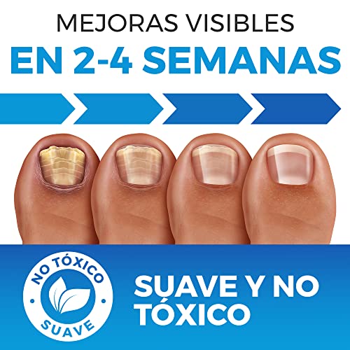 Tratamiento Hongos Uñas Pies con Lima De Uñas | Eliminador de hongos en las uñas | Nail Mycosis | Extra Grande 75ML