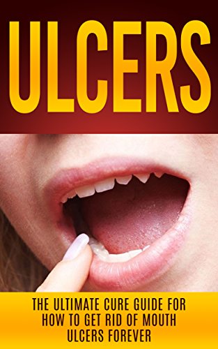 Ulcers: The Ultimate Cure Guide for How to Get Rid of Mouth Ulcers Instantly (Ulcer Free, Ulcer Diet, Mouth Ulcer Cure, Oral Ulcer) (English Edition)