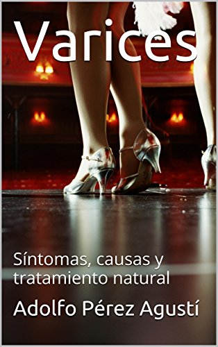 Varices: Síntomas, causas y tratamiento natural