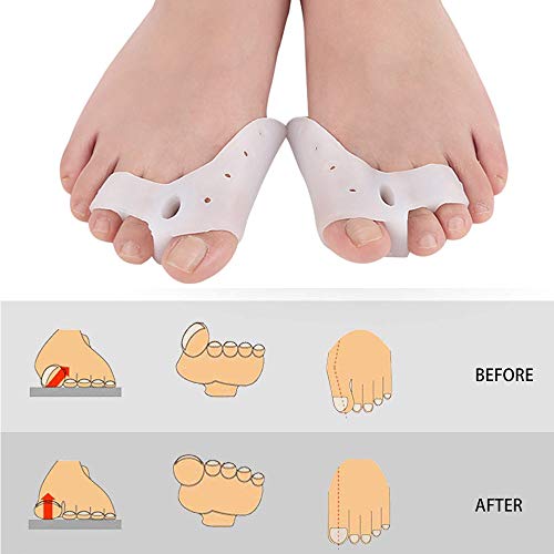 ZYXZXC Ortesis De Dedo del Pie Correctores De Dedos para Dedos De Martillo Separador De Dedos Pies De Gel De Silicona 1PCS